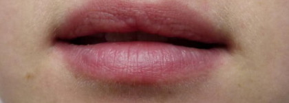 Clinique Chubby Stick Moisturizing Lip Colour Balm # 06 Woppin` watermelon