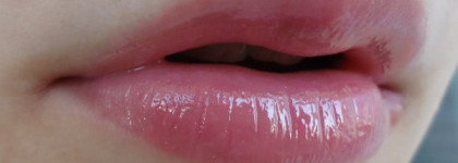 Лето с блеском