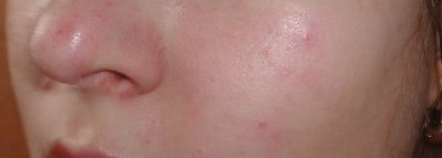 Вся правда о минеральной пудре Vichy Aera Teint Mineral Powder 10 opal