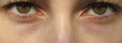 От бессонных глаз — Пара консилеров от MAC