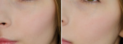 Catrice SpectaculArt — Limited Edition — Mousse Blush