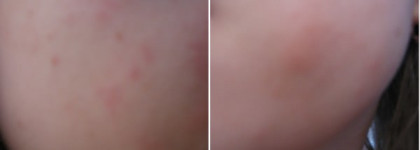 Пластилиновая ворона - Revlon Colorstay Foundation Makeup With SoftFlex For Normal/Dry Skin, #110 Ivory