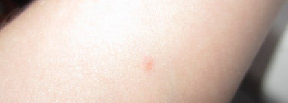 Michel Laboratory StopProblem Салициловый маскирующий карандаш антибактериальный (тон 1)