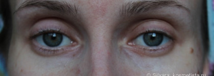 Отзыв: маска Биобьюти № 2 вокруг глаз