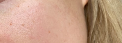 Хиты Clarins. Любимое проверенное средство И кое-что ещё. Clarins SOS Primer Rose 01 & Clarins Instant Concealer 01