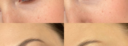 Первый Bernovich sparkle 21. Оттенок один, а фото много