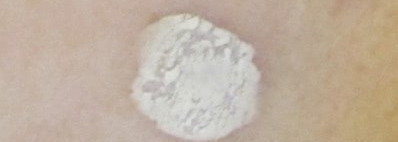 Anna Lotan A-Clear - Herbal Drying Lotion