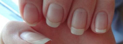 Наши ноготки требуют помощи