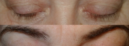 Двойной эксперимент с Almea Xlash Serum