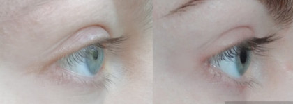 Двойной эксперимент с Almea Xlash Serum