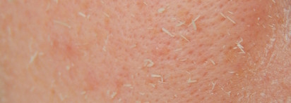 Пилинг для лица Christina Peeling Gommage with Vitamin E