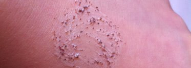 Два плюса и минус от Чистой Линии