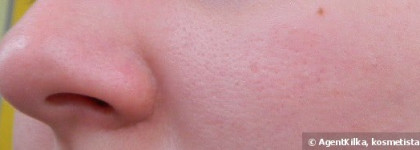 Бьюти-батл 3х средств для уменьшения пор: Benefit The Porefessional, Etude House Goodbye Pore Ever и Tony Moly Egg Pore