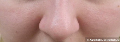 Бьюти-батл 3х средств для уменьшения пор: Benefit The Porefessional, Etude House Goodbye Pore Ever и Tony Moly Egg Pore