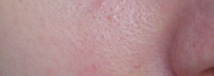 В борьбе за идеальную кожу (часть 1): Серия Expert Pharma от Faberlic