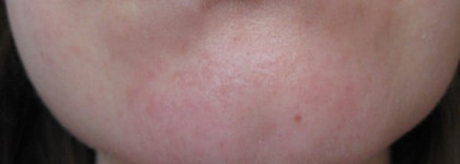 В борьбе за идеальную кожу (часть 1): Серия Expert Pharma от Faberlic