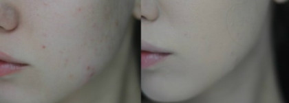 Хвойная маскировка c Innisfree Jejubija Anti-trouble BB Cream Spf35 PA++ 30ml Foundation