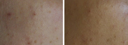 BareMinerals 9 Piece Get Started Kit Medium