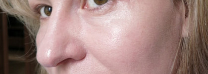 Skin79, BB парад :)