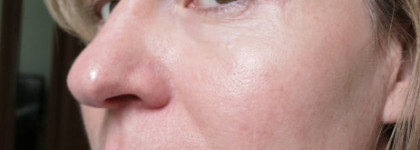 Skin79, BB парад :)