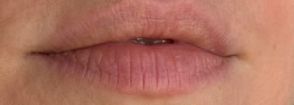 Любимый уход за губами: Shik total repair balm