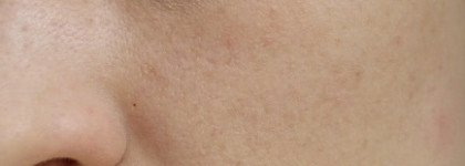 Guerlain Meteorites Perles Iluminating Powder Pure Radiance в оттенке 01 на "неидеальной" коже. Необходимость или пустая трата