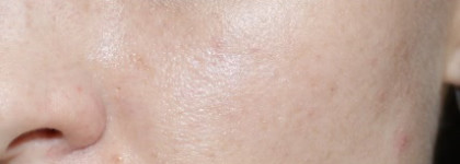 Guerlain Meteorites Perles Iluminating Powder Pure Radiance в оттенке 01 на "неидеальной" коже. Необходимость или пустая трата