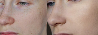 Как я скрываю свои веснушки (часть 2). ББ крем с плотным покрытием Lioele Triple Solution BB cream