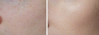 Как я скрываю свои веснушки (часть 2). ББ крем с плотным покрытием Lioele Triple Solution BB cream