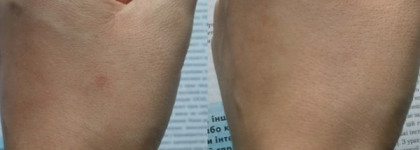 Как я скрываю свои веснушки (часть 2). ББ крем с плотным покрытием Lioele Triple Solution BB cream