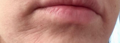 Функциональная дерматологическая белорусская косметика Sativa. Действительно работает