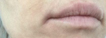 Функциональная дерматологическая белорусская косметика Sativa. Действительно работает