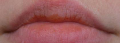 Ох, уж этот Lucas Papaw Ointment