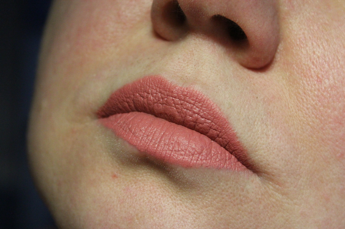 Подчеркнутая сухая область по центру верхней губы и неровный контур нижней.