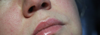 Essence The Super Peptide Glossy Lip Treatment 01 Peptacular