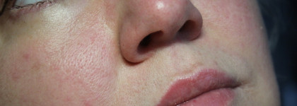 Essence The Super Peptide Glossy Lip Treatment 01 Peptacular