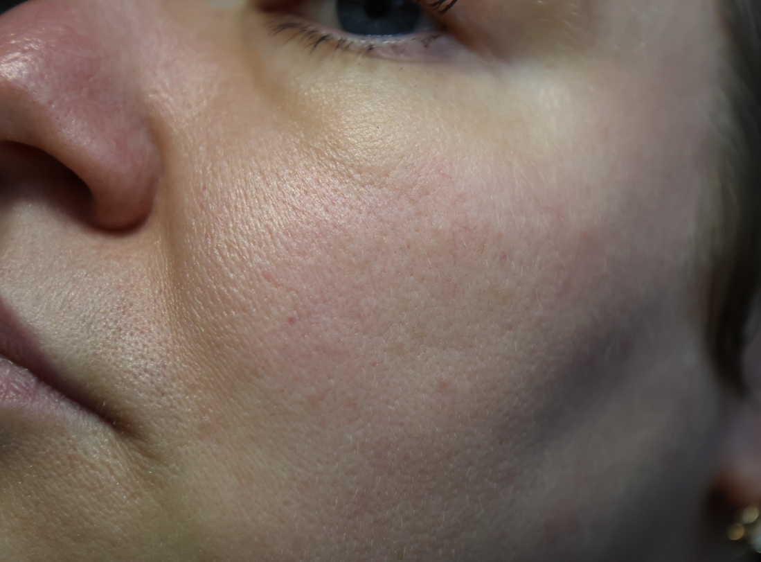 Поры ближе.