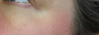 Одни из самых лучших моих румян - Chantecaille The Pebble Refillable Compact + Chantecaille Cheek Shade в оттенке Fun