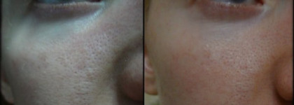 Чудо от La Mer ?