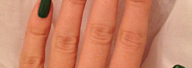 Травка зеленеет или тоска зеленая?