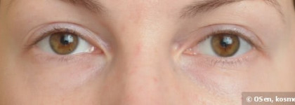Увлажняющий консилер Dior Diorskin Nude Skin-Perfecting Hydrating Concealer в оттенке 001 Ivory