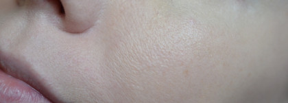 Pleyana Glycolic Acid Gel Peel