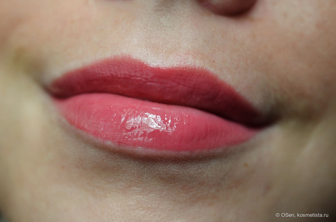 Разбили губы((((Нужен совет — 12 ответов | форум Babyblog