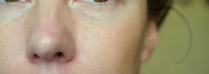 Как за 10 минут привести кожу в идеальное состояние