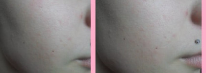 Этюд в розовых тонах Skin79 Hot Pink Super Plus Beblesh Balm