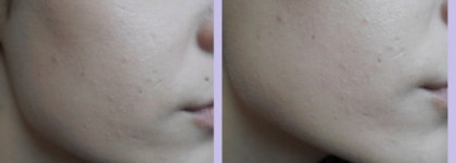 Отличник The Face Shop Power Perfection BB Cream #2 Natural Beige