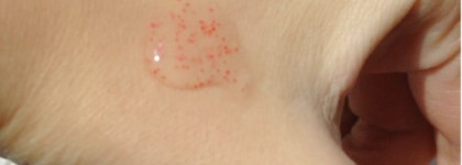 Чистота и нежность воздействия - возможно?