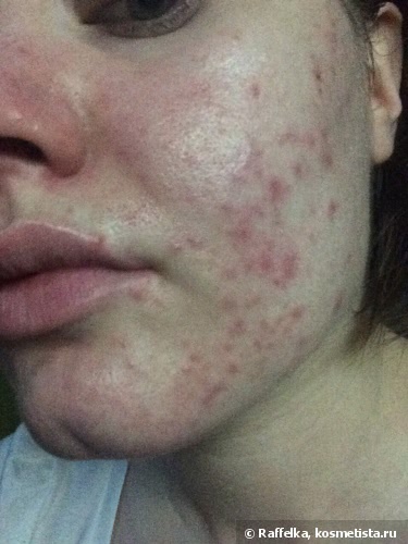 Мои помощники в уходе за кожей лица. Шаг первый. Очищение