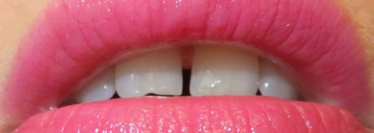 Clinique Chubby Stick Moisturizing Lip Colour Balm 15 pudgy peony