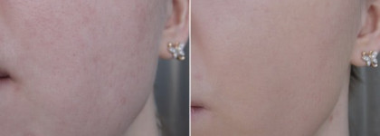 Eisenberg Invisible corrective makeup 01 natural / Тональная основа